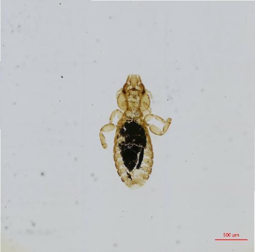 Strigiphilus microgenitalis Carriker, 1966 - 010693576__2017_08_11-Scene-1-ScanRegion0