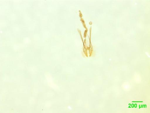 Histeridae Gyllenhal, 1808 - 010189753___7