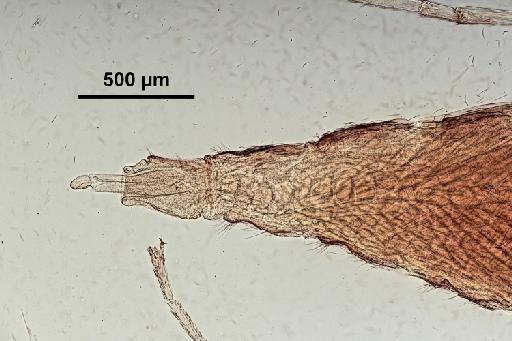 Mayetiola phalaris Barnes, 1927 - 010210368-Mayetiola_phalaris-SYNTYPE-250619-terminalia-100_0x-scale