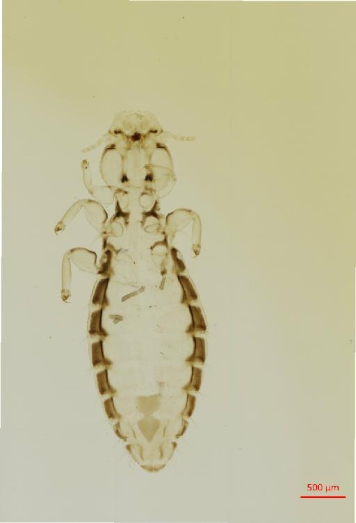 Ornithobius matthewsi Balat, 1974 - 010679651__2017_08_08-Scene-1-ScanRegion0