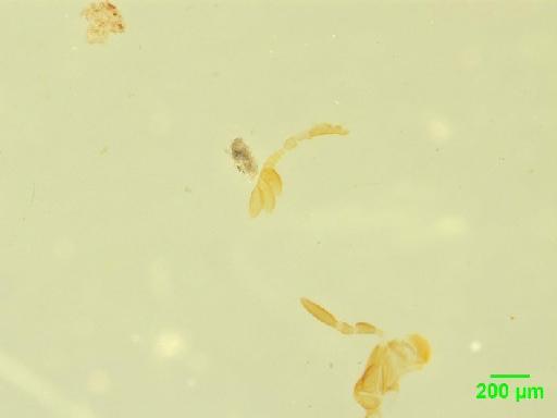 Aphodiinae Leach, 1815 - 010189799___4