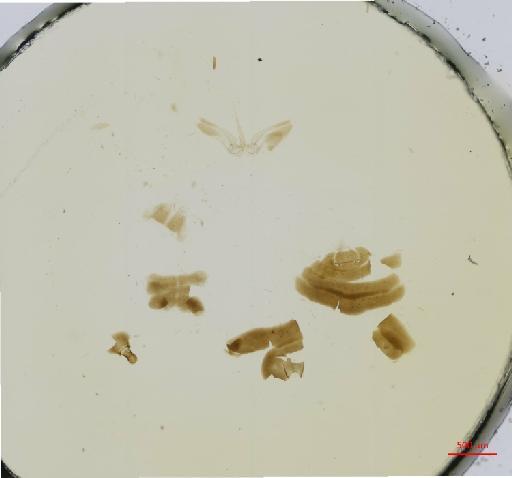 Hexacladia glaucus Noyes, 2010 - 010178957__2017_01_31-Scene-3-ScanRegion2