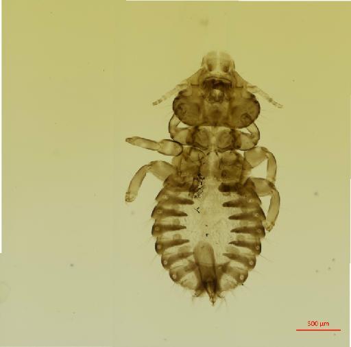 Ibidoecus australis Kumar & Tandan, 1966 - 010677897__2017_08_08-2-Scene-1-ScanRegion0