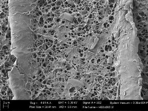 Nitella confervacea (Brébisson) A.Braun ex Leonh. - OosporeDetail