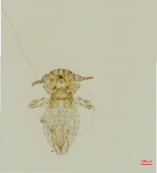 Neotrichodectes (Conepaticola) interruptofsciatus Kellogg & Ferris, 1915 - 010697267__2017_08_16-Scene-1-ScanRegion0