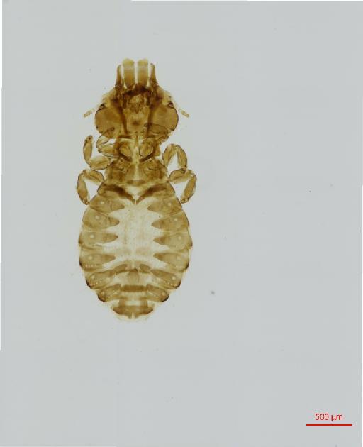 Ibidoecus bimaculatus Mjoberg, 1910 - 010677909__2017_08_08-2-Scene-1-ScanRegion0