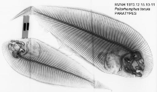 Peltorhamphus tenuis James, 1972 - BMNH 1970.12.15.10-11 Peltorhamphus tenuis PARATYPES