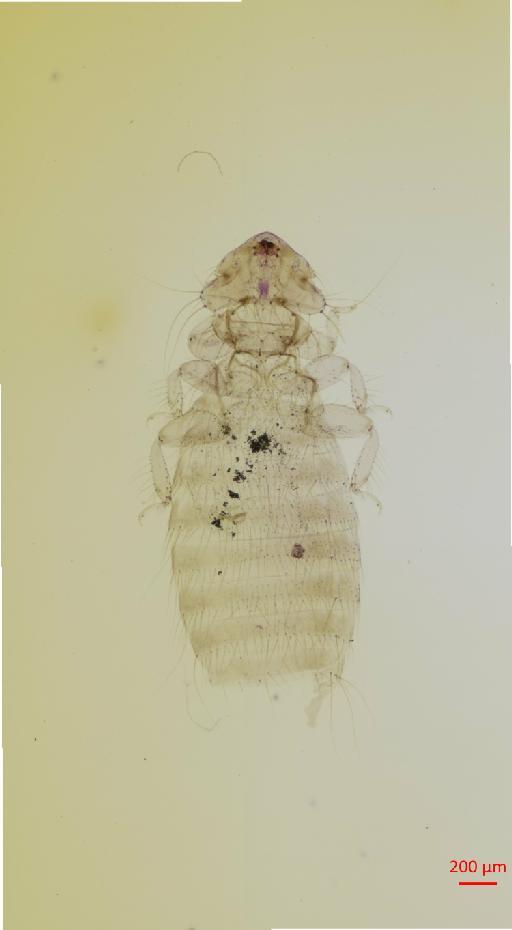 Amyrsidea (Argimenopon) himalayensis Scharf & Price, 1983 - 010651781__2017_07_18-Scene-1-ScanRegion0