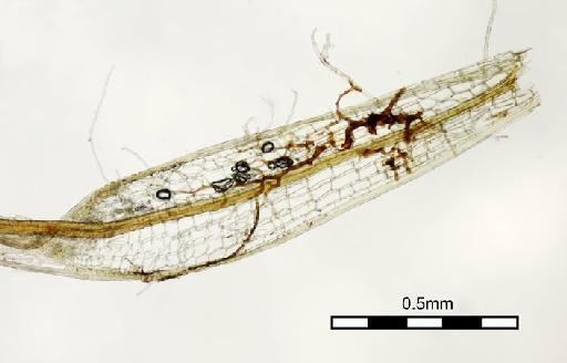 Syrrhopodon albidus Thwaites & Mitt. in Mitt. - Syrrhopodon albidus_BM000676790mainleafbody