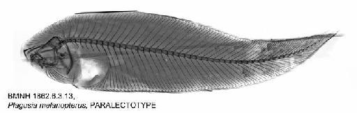 Cynoglossus melanopterus Shen, 1969 - BMNH 1862.6.3.13, Plagusia melanopterus, PARALECTOTYPE, Radiograph