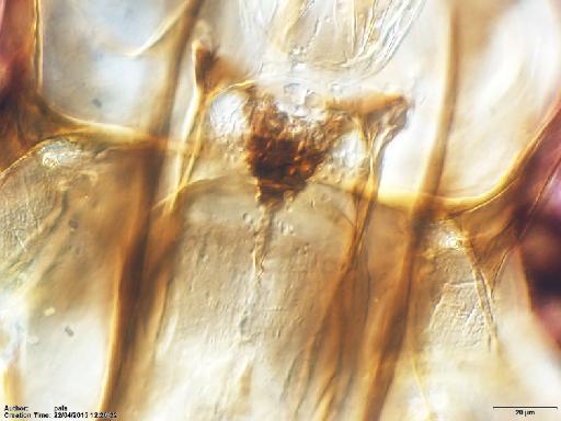 Lutzomyia (Nyssomyia) shawi Fraiha et al., 1981 - Lutzomyia_shawi_BMNH(E)1251317_PT-female_cibarium-40x.tif