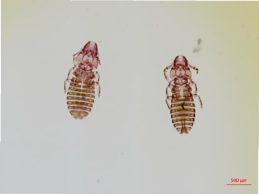 Rallicola insulanus Carriker, 1949 - 010690067__2017_08_10-Scene-1-ScanRegion0