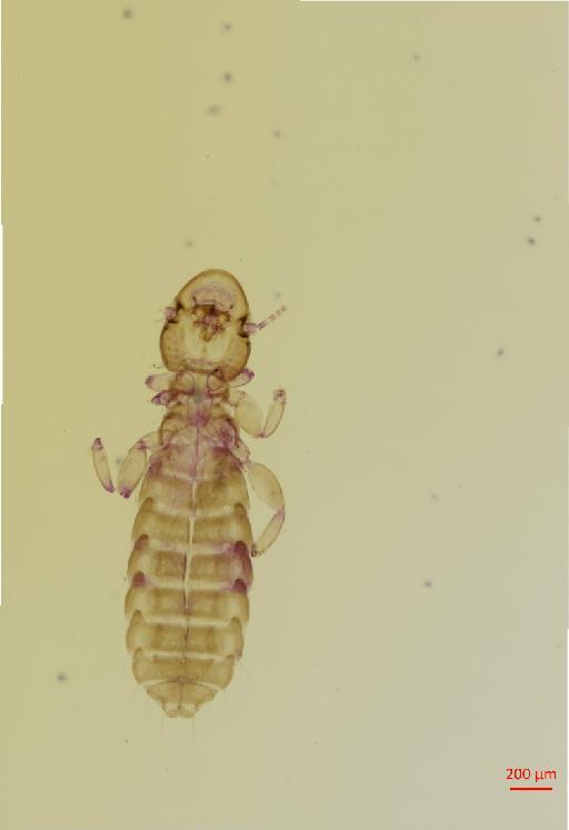 Syrrhaptoecus mitratus Waterston, 1928 - 010694761__2017_08_15-Scene-1-ScanRegion0