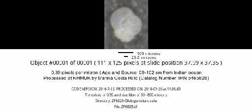 Globigerinita uvula (Ehrenberg) - ZF6828-Globigerinita-uvula_obj00001_plane000.jpg