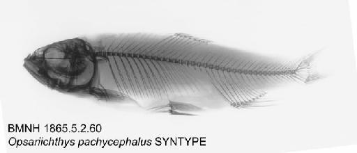 Opsariichthys pachycephalus Günther, 1868 - BMNH 1865.5.2.60 - Opsariichthys pachycephalus SYNTYPE Radiograph