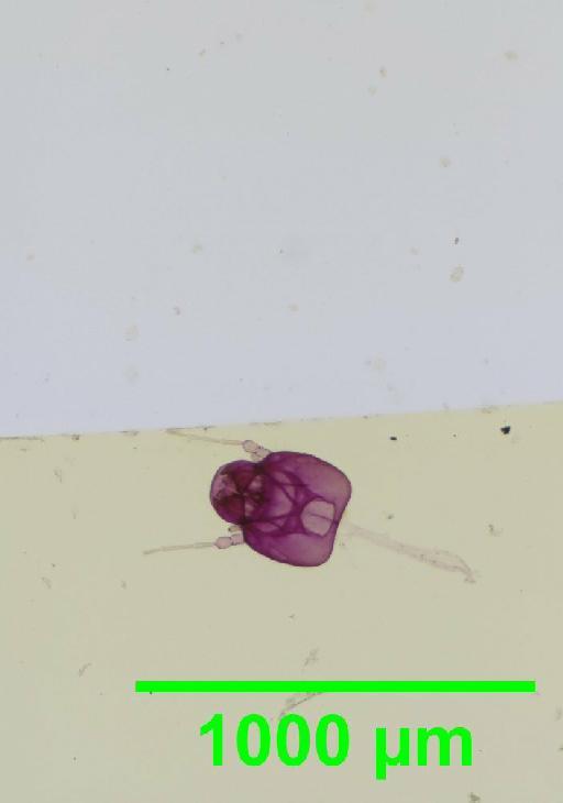 Liposcelis albothoracicus Broadhead, 1955 - 010150241__2016_03_15-4_s11