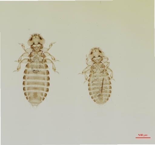 Heteromenopon (Keamenopon) kalamundae Price, 1969 - 010657158__2017_07_21-Scene-1-ScanRegion0