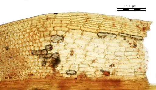 Bryoerythrophyllum campylocarpum (Müll.Hal.) H.A.Crum - Syrrhopodon jamesonii_BM000960221leafbase2