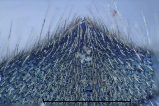 Ceratina capitosa Smith, F., 1879 - Ceratina_capitosa_Hym17b325_metasomatipdo