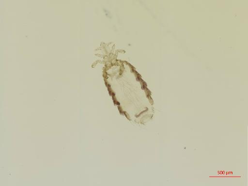 Haematopinoides squamosus Osborn, 1891 - 010685716__2017_08_18-Scene-1-ScanRegion0