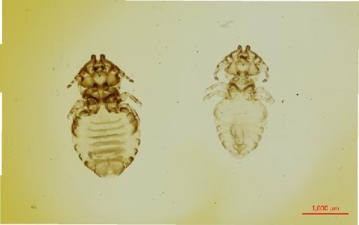 Cebidicola armatus Neumann, 1913 - 010695858__2017_08_15-Scene-1-ScanRegion0