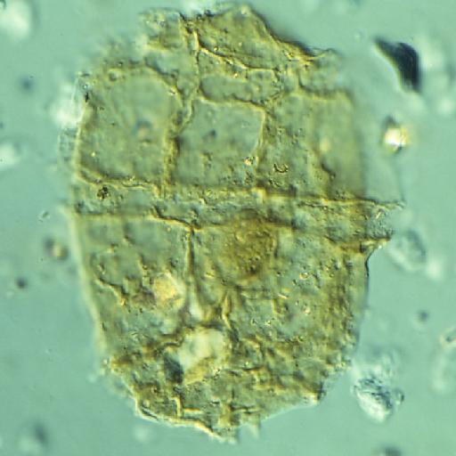 Egmontinium polyplacophorum Gitmez & Sarjeant, 1972 - FD143(1)-2.tif