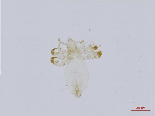 Linognathus taurotragus strepsicerati Weisser - 010699380__2017_08_18-1-Scene-1-ScanRegion0