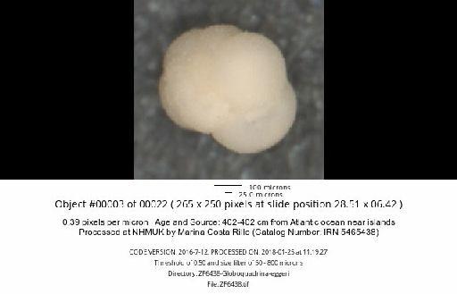 Neogloboquadrina dutertrei (d'Orbigny) - ZF6438-Globoquadrina-eggeri_obj00003_plane000.jpg