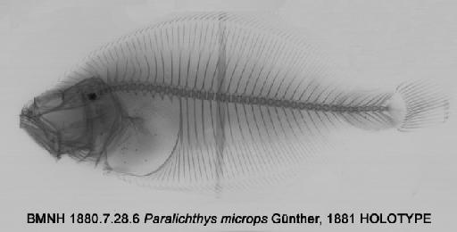 Paralichthys microps (Günther, 1881) - BMNH 1880.7.28.6 Paralichthys microps HOLOTYPE radiograph