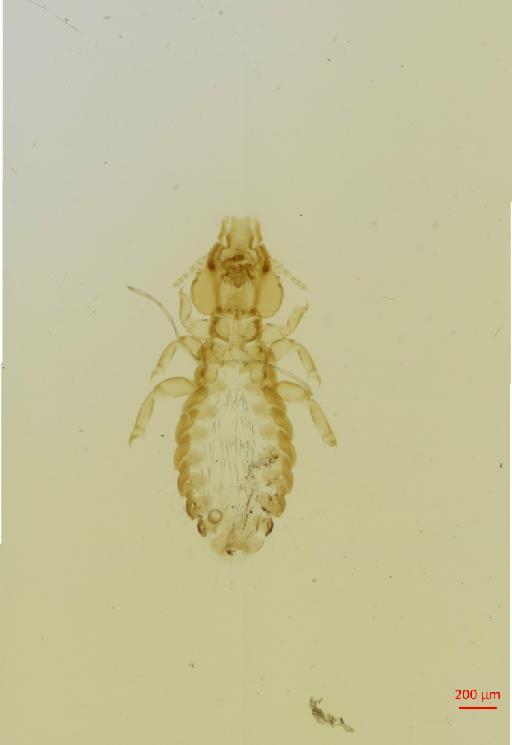 Strigiphilus senegalensis Tendeiro, 1963 - 010693922__2017_08_11-Scene-3-ScanRegion2