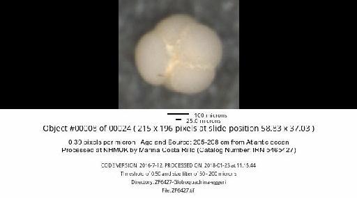 Neogloboquadrina dutertrei (d'Orbigny) - ZF6427-Globoquadrina-eggeri_obj00008_plane000.jpg