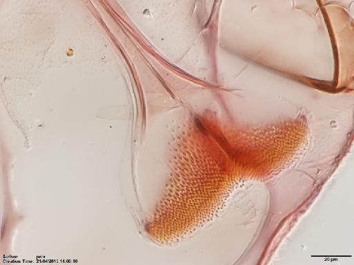 Lutzomyia (Micropygomyia) duppyorum Fairchild & Trapido, 1950 - Lutzomyia_duppyorum-BMNH(E)1722070_PT-female_pharynx-40x.tif