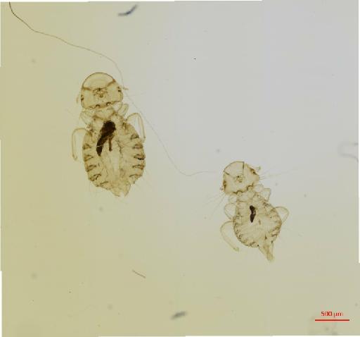 Chelopistes longisetosa Carriker, 1945 - 010673313__2017_07_31-Scene-1-ScanRegion0