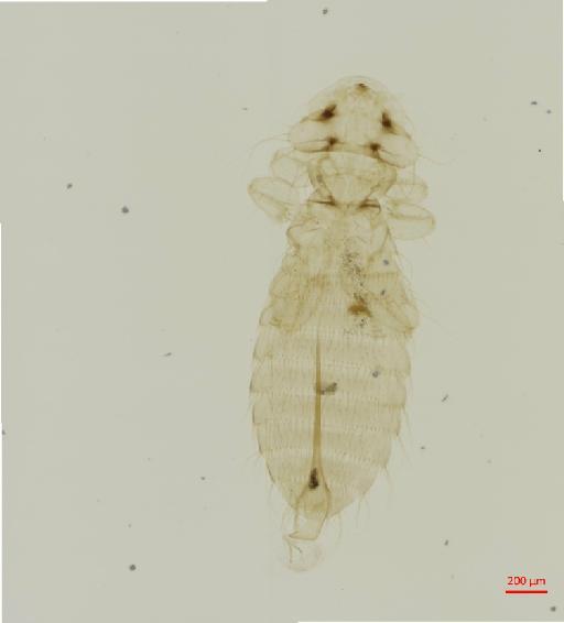 Heteromenopon sincipitialis Carriker, 1954 - 010657149__2017_07_21-Scene-1-ScanRegion0