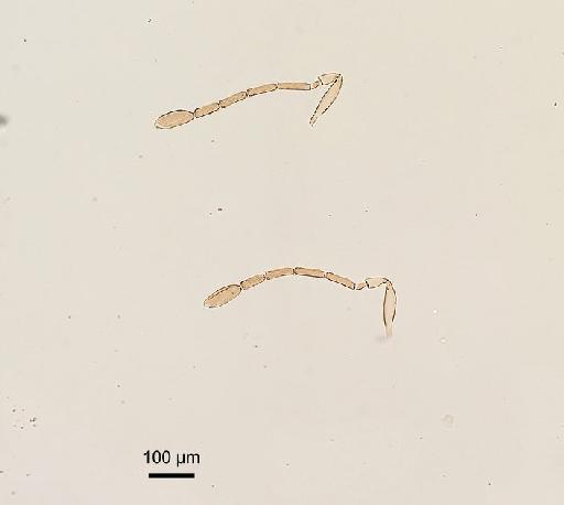 Arescon confusus Triapitsyn, 2016 - Arescon mudigerensis Subba Rao, 1989 #1414689 PT antennae