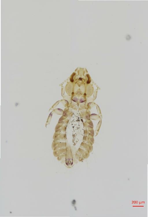 Strigiphilus bramae Qadri, 1938 - 010693314__2017_08_11-Scene-1-ScanRegion0