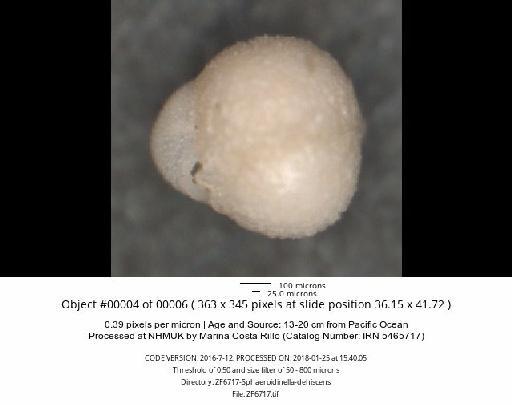 Sphaeroidinella dehiscens (Cushman) - ZF6717-Sphaeroidinella-dehiscens_obj00004_plane000.jpg