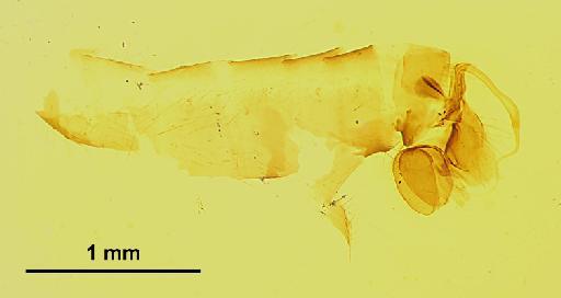 Rhamphomyia flavirostris Walker, 1849 - 010398018-Rhamphomyia_flavorostris-abdomen2-B-40_0x-scale