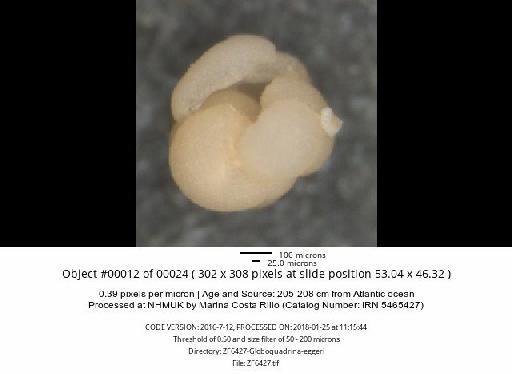 Neogloboquadrina dutertrei (d'Orbigny) - ZF6427-Globoquadrina-eggeri_obj00012_plane000.jpg