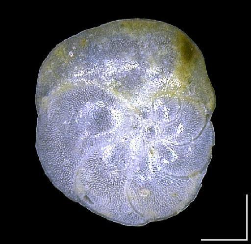 Cristellaria variabilis Reuss, 1850 - ZF1384_Discorbinella bertheloti1_umbilical.tif