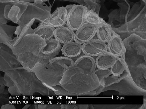 Syracosphaera bannockii - 148-01.TIF