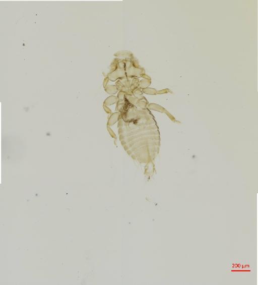 Myrsidea neocinereae Price et al., 2005 - 010660813__2017_07_26-Scene-2-ScanRegion1