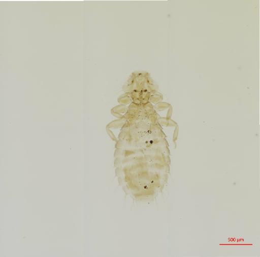 Myrsidea satbhai Ansari, 1951 - 010661099__2017_07_26-Scene-1-ScanRegion0