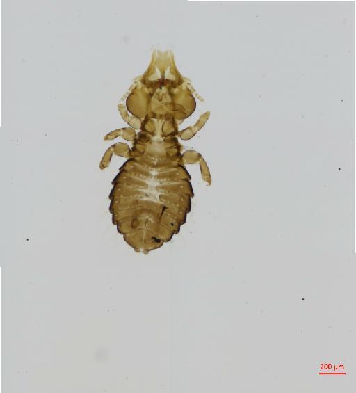 Saemundssonia incisa Timmermann, 1950 - 010691268__2017_08_11-Scene-1-ScanRegion0