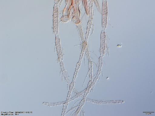 Lutzomyia odax species group Verrucarum Fairchild & Hertig, 1961 - Lutzomyia_odax-BMNH(E)1722055_PT-female_palpi-10x.tif