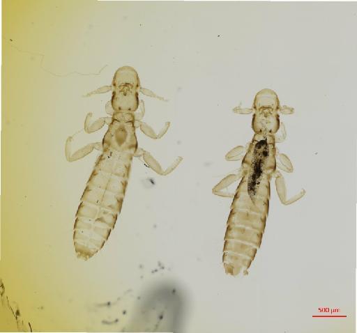 Oxylipeurus baileyi pucrasia Clay, 1938 - 010682560__2017_08_09-Scene-1-ScanRegion0