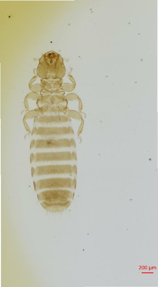 Longimenopon ellioti Timmermann, 1957 - 010657937__2017_07_24-Scene-1-ScanRegion0