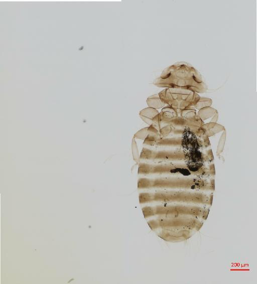 Austromenopon squatarolae Timmermann, 1954 - 010652140__2017_07_19-Scene-1-ScanRegion0