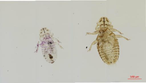 Myrsidea singularis Tandan, 1972 - 010661196__2017_07_26-Scene-1-ScanRegion0