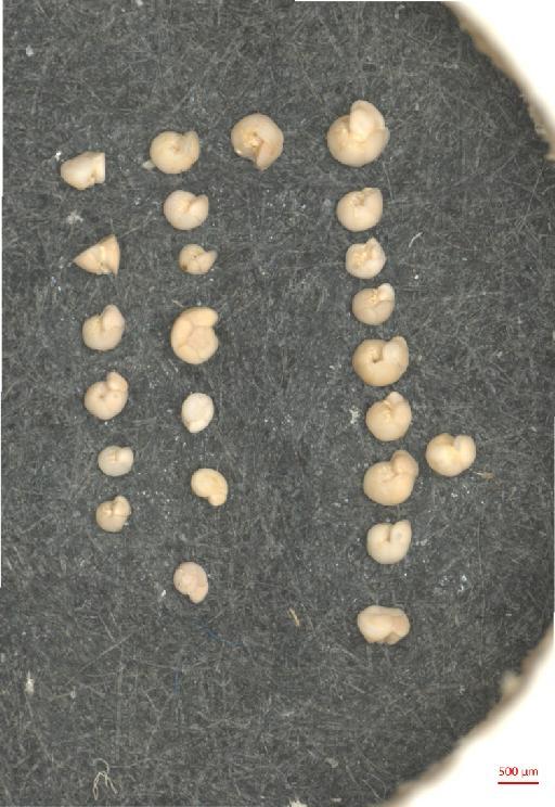 Globorotalia truncatulinoides (d'Orbigny) - ZF5856